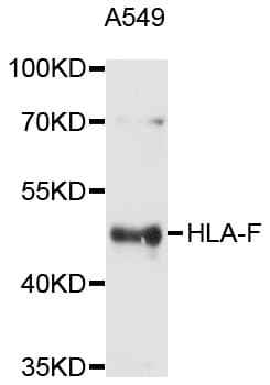 IHC-plus™ HLA-F Antibody
