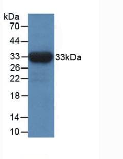 IDH1 / IDH Antibody