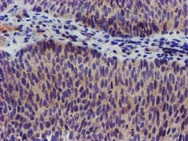KCNJ3 / GIRK1 Antibody (clone OTI3E11)