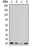 Polyclonal Rabbit anti-Human CETN1 Antibody (IHC, WB)