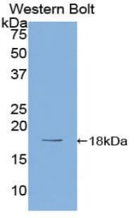 PR / Progesterone Receptor Antibody (aa672-790)