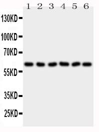 PAK1 Antibody (aa1-14)