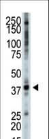 TRB3 / TRIB3 Antibody (aa301-331)