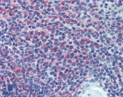 CD8B / CD8 Beta Antibody (aa21-208)