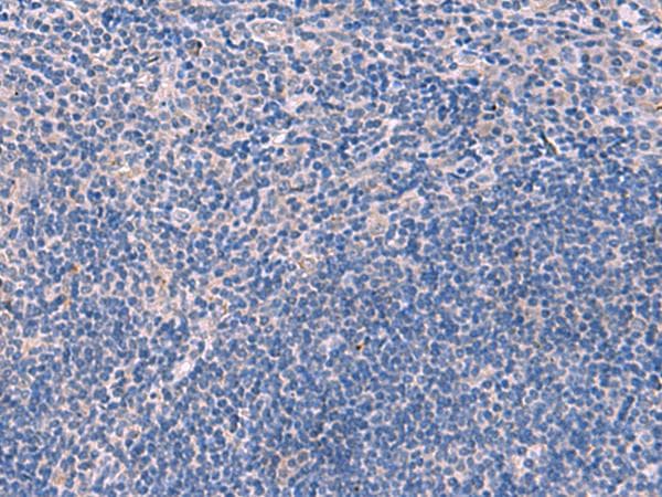 SCCPDH Antibody