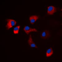 CaMKII Alpha+Delta Antibody (phospho-Thr286)