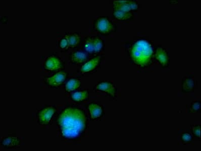 Polyclonal Rabbit anti-Human ER Alpha / Estrogen Receptor Antibody (IHC)