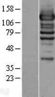 WDR44 Protein (Over-Expression Lysate Myc-DDK (Flag))