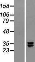 NDUFAF5 Protein (Over-Expression Lysate Myc-DDK (Flag))