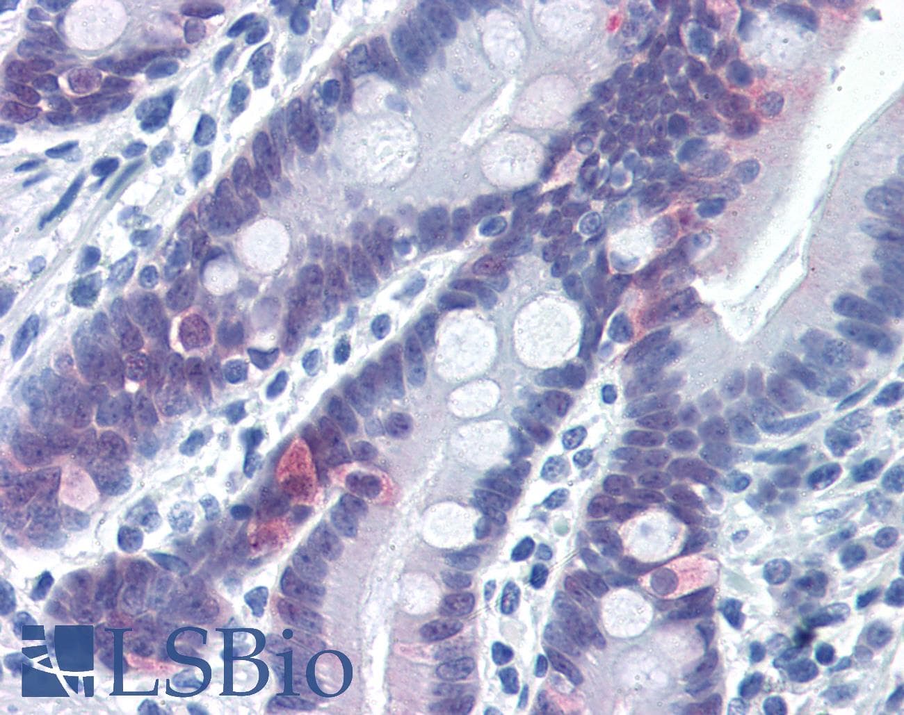 IHC-plus™ Polyclonal Rabbit anti-Mouse CASP6 / Caspase 6 Antibody (Cleavage Site, IHC, WB)