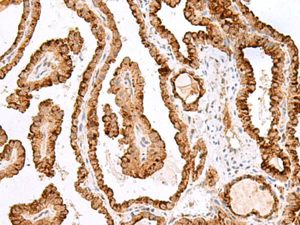 Polyclonal Rabbit anti-Human SAXO2 / FAM154B Antibody (IHC)