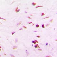 Polyclonal Rabbit anti-Human PINX1 Antibody (Internal, IHC, WB)