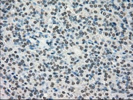 TYRO3 Antibody (clone OTI5B4)