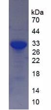 Human SIRT2 / Sirtuin 2 Protein (Recombinant His-T7)