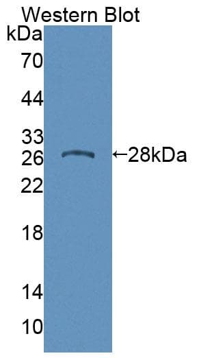 DOK1 Antibody (aa18-237)