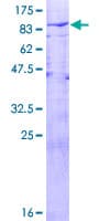 Human USP21 Protein (Recombinant GST)