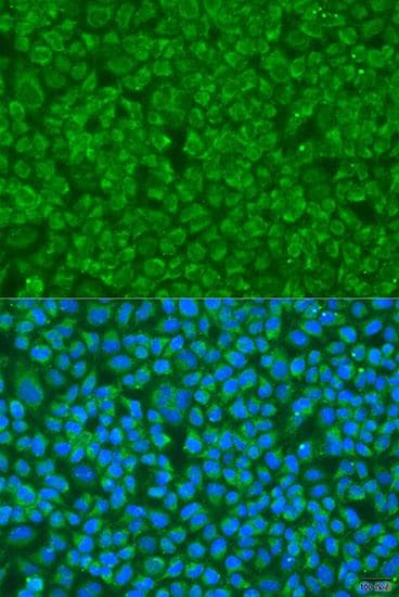 GS28 / GOSR1 / p28 Antibody
