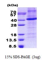 Human FST / Follistatin Protein (Recombinant His)