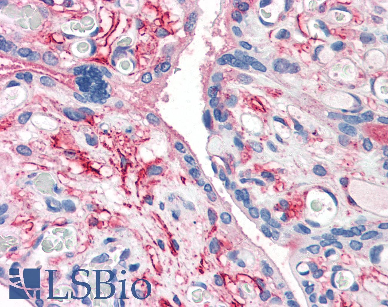 IHC-plus™ Polyclonal Rabbit anti-Human DPP4 / CD26 Antibody (Internal, IHC)