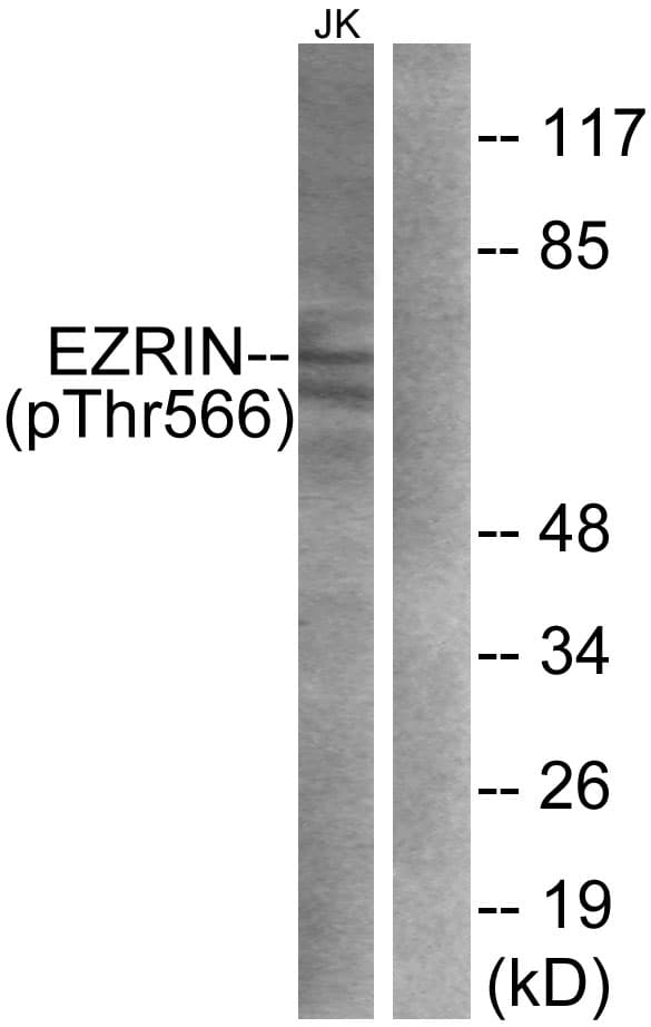 EZR / Ezrin Antibody (phospho-Thr566)