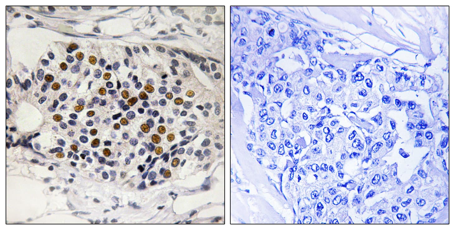 p16INK4a / CDKN2A Antibody (phospho-Ser152)