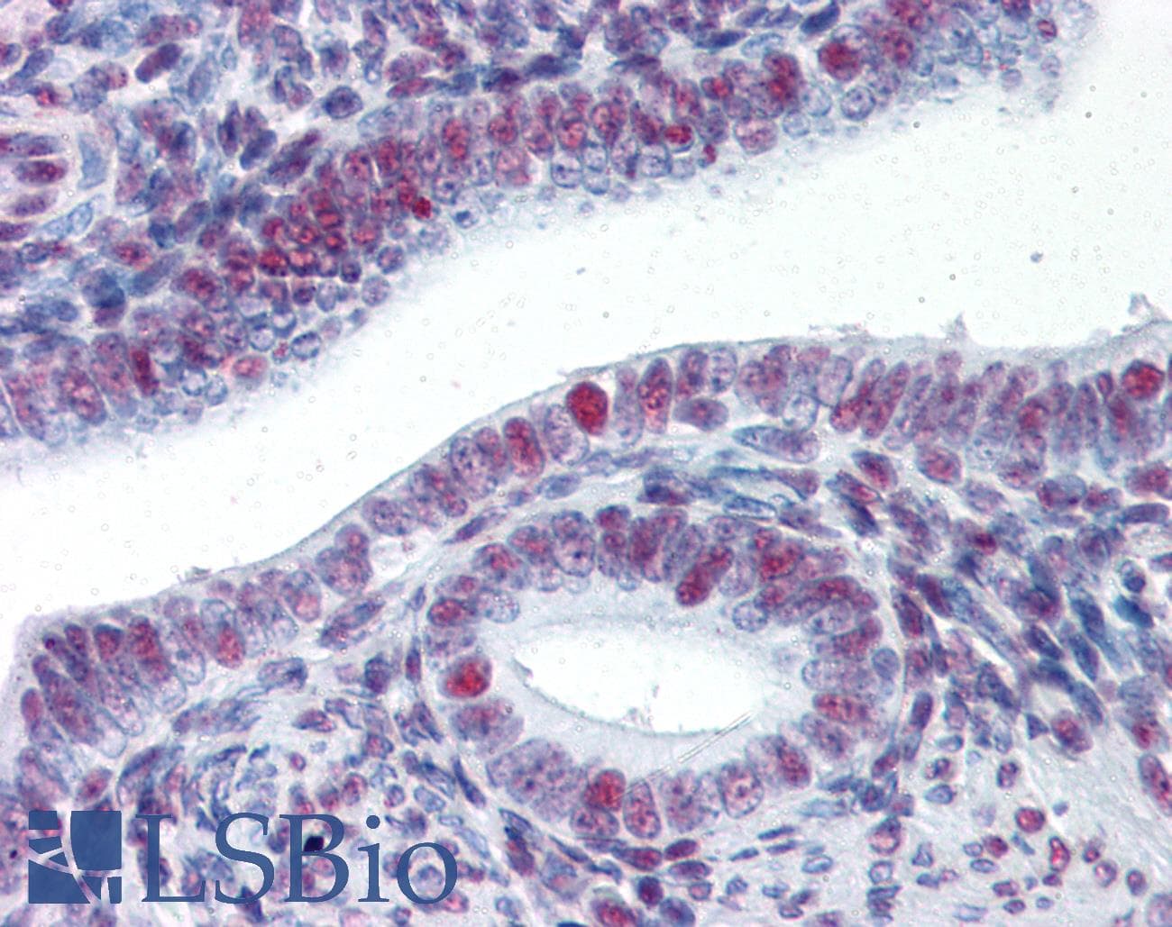 IHC-plus™ Polyclonal Rabbit anti-Human HSF1 Antibody (IHC, WB)