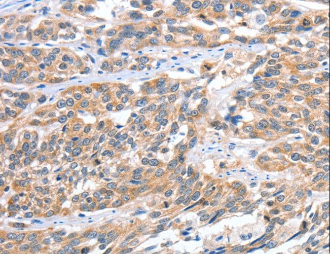 CGB / hCG Beta Antibody