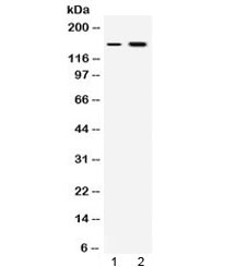 Polyclonal Rabbit anti-Human INSR / Insulin Receptor Antibody (WB)