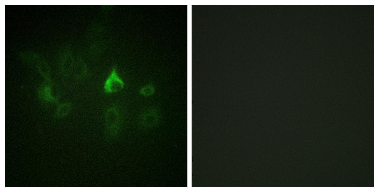 Polyclonal Rabbit anti-Human ETK / BMX Antibody (Tyr566, IHC, IF, WB)
