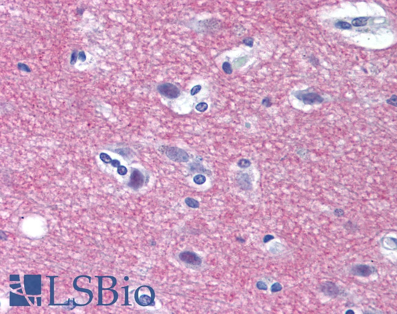 IHC-plus™ STX1A / Syntaxin 1A Antibody (N-Terminus)