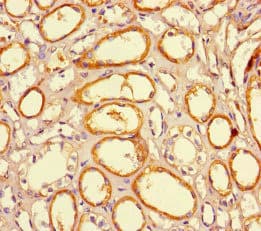 JARID2 / JMJ Antibody