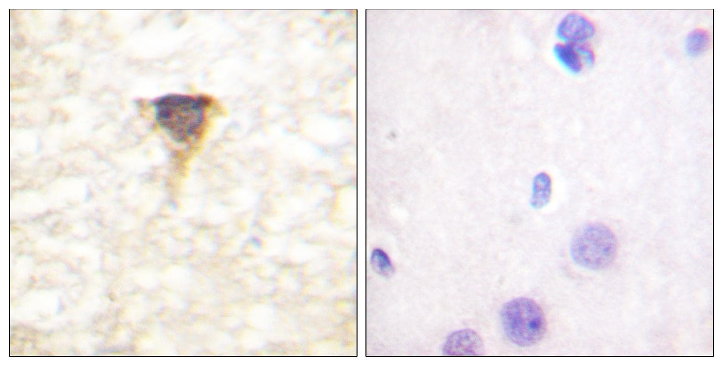 Polyclonal Rabbit anti-Human CAMK4 / CaMK IV Antibody (p196/200, IHC, IF, WB)