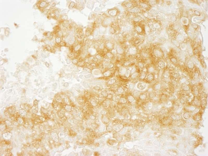 DIAPH1 Antibody (aa1200-C-term)