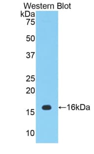 PTGS2 / COX2 / COX-2 Antibody (aa240-351, FITC)