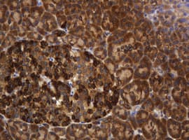 Monoclonal Mouse anti-Human TAPBPL / TAPBPR Antibody (clone OTI3D8, IHC, WB)