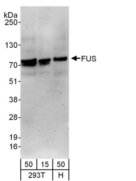 Polyclonal Goat anti-Human FUS / TLS Antibody (aa1-50, IHC, WB)
