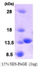Human PLA2G16 / HRASLS3 Protein (Recombinant)
