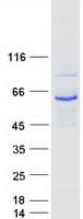 Human Rhodopsin Kinase / GRK1 Protein (Recombinant Myc-DDK (Flag))