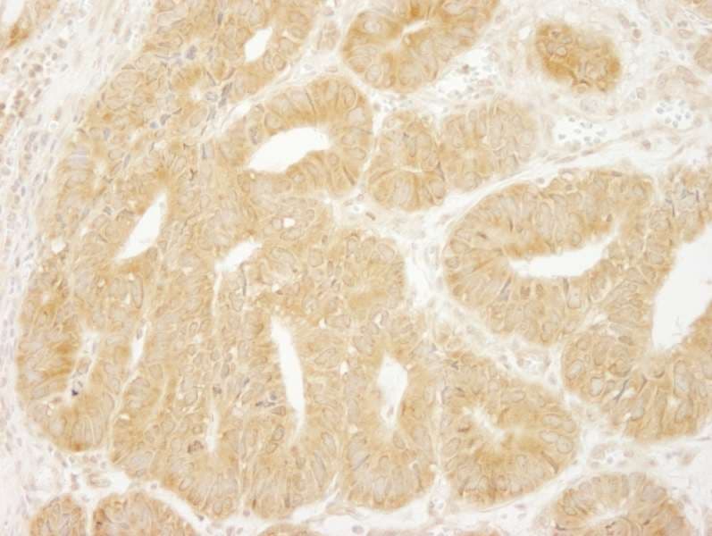 EIF2A / EIF2 Alpha Antibody (aa525-575)