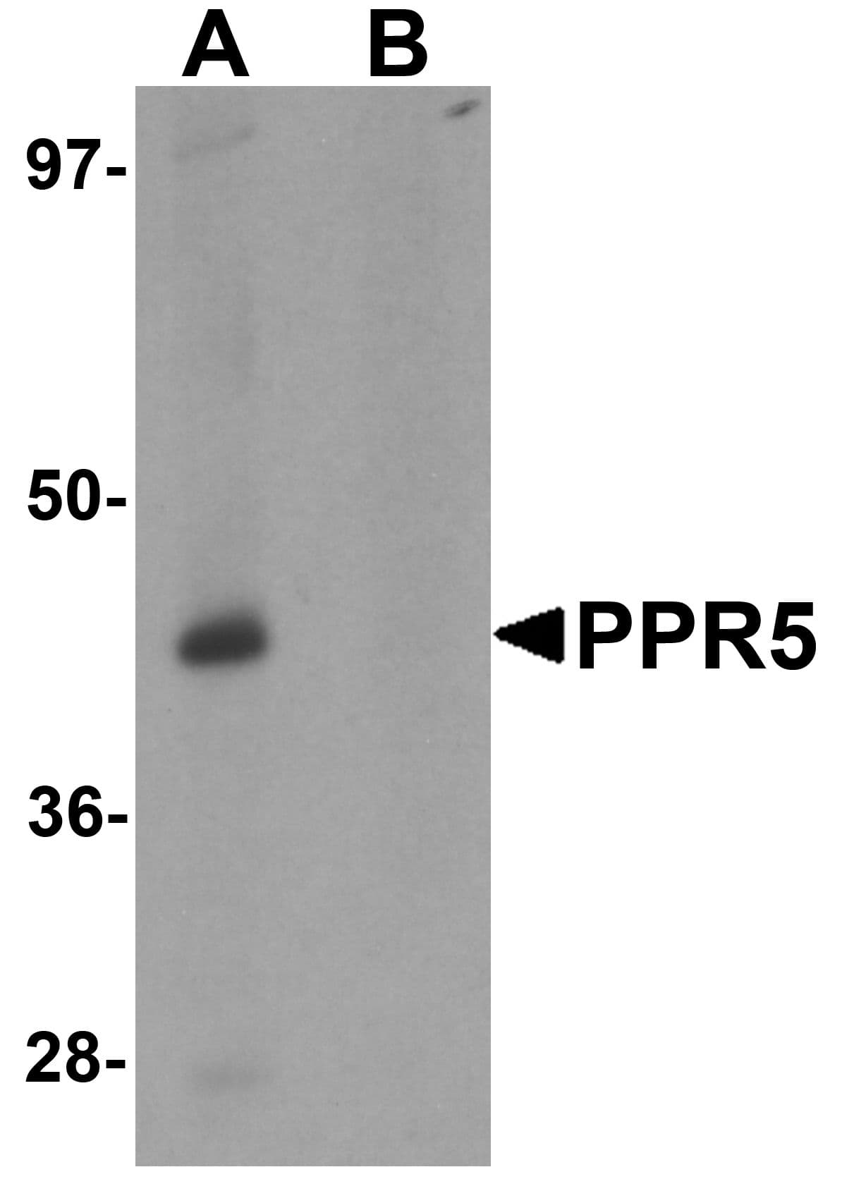 IHC-plus™ Polyclonal Rabbit anti-Human PRR5 Antibody (IHC, IF, WB)