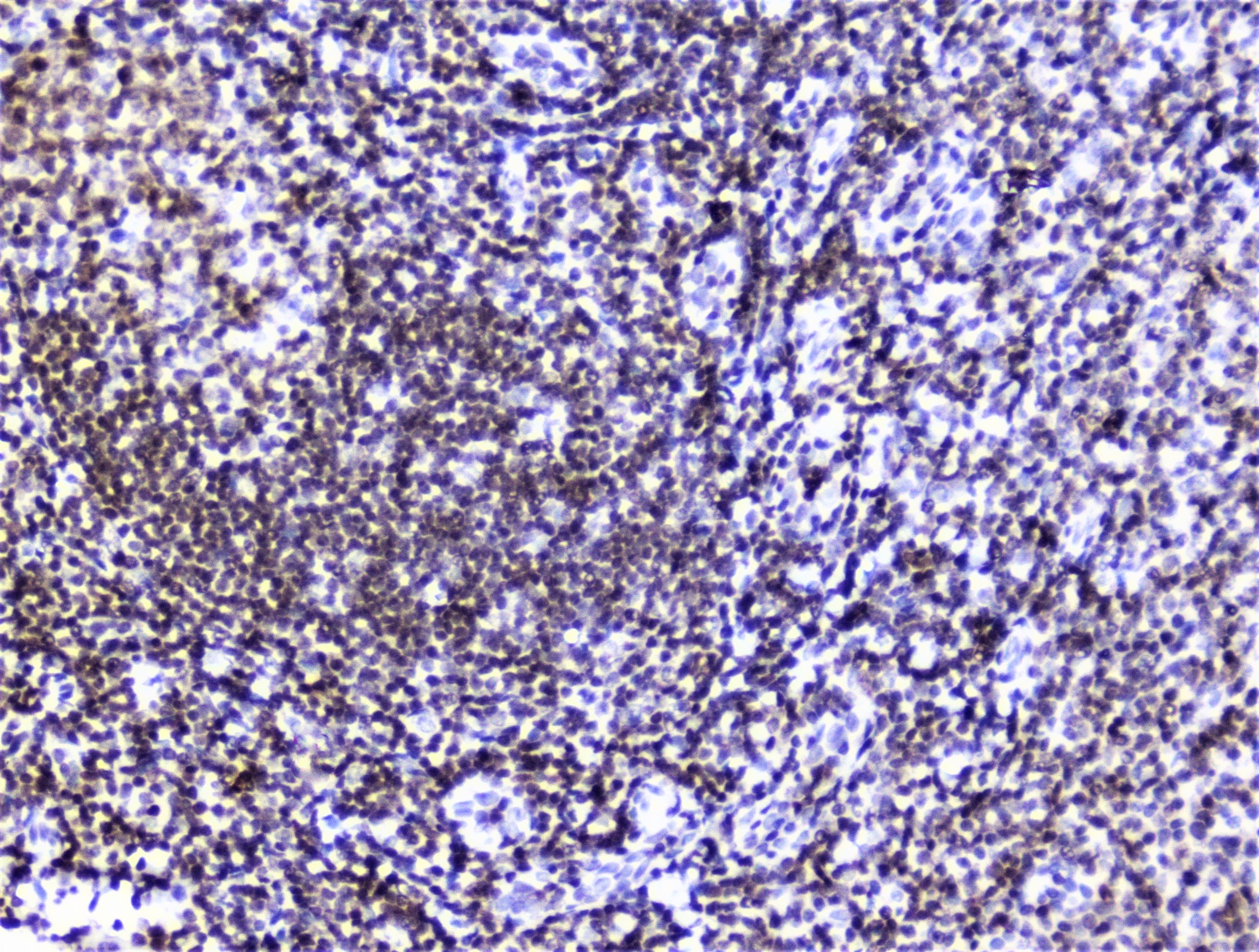 HMGN2 Antibody