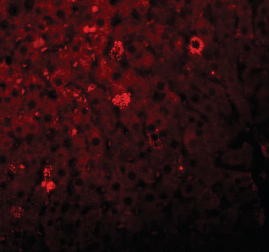 LYRM1 Antibody
