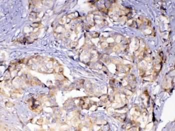 Polyclonal Rabbit anti-Human ASL / Argininosuccinate Lyase Antibody (IHC, WB)