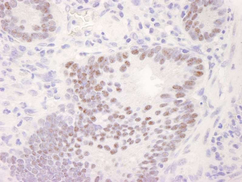 Polyclonal Rabbit anti-Human CDK11A / CDC2L2 Antibody (aa730-C-term, IHC)