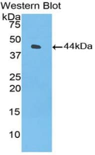 Complement C3 Antibody (aa1322-1661)