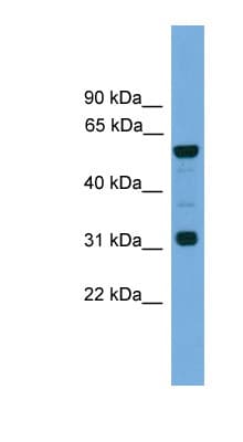 GJA10 / CX62 / Connexin 62 Antibody (N-Terminus)