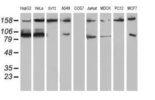 ATRIP Antibody (clone OTI5E7)