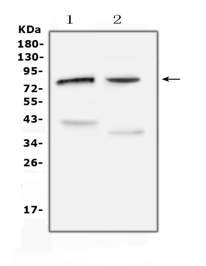 Polyclonal Rabbit anti-Human CHAT Antibody (IHC, WB)