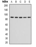 CHUK/IKBKB Antibody (Internal)