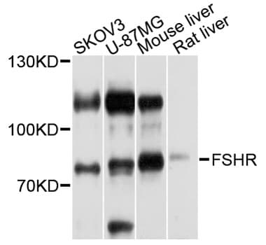FSH Receptor / FSHR Antibody